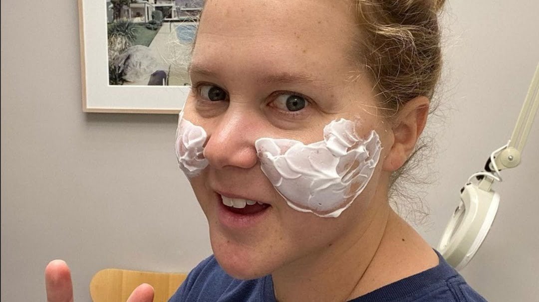 Read more about the article Amy Schumer disfigured through surgery, she is pressured to dissolve the injected product