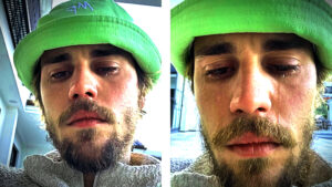 Read more about the article Justin Bieber 2025: Health Challenges, Relationship Revolution